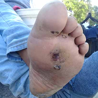 Vacunación y Contracepción